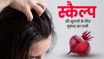  सिर पर इन 3 तरीकों से लगाएं चुकंदर का पानी, दूर होगी खुजली और डैंड्रफ की समस्या