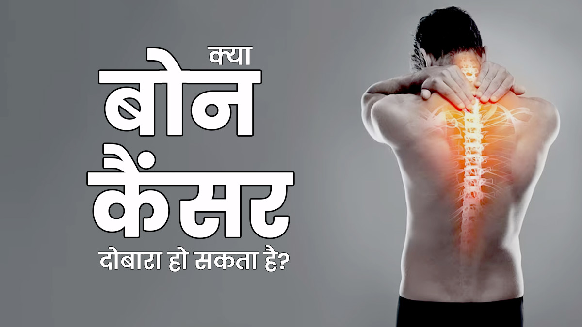 क्या एक बार ठीक होने के बाद दोबारा हो सकता है बोन कैंसर? डॉक्टर से जानें सावधानियां