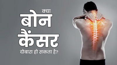 क्या एक बार ठीक होने के बाद दोबारा हो सकता है बोन कैंसर? डॉक्टर से जानें सावधानियां