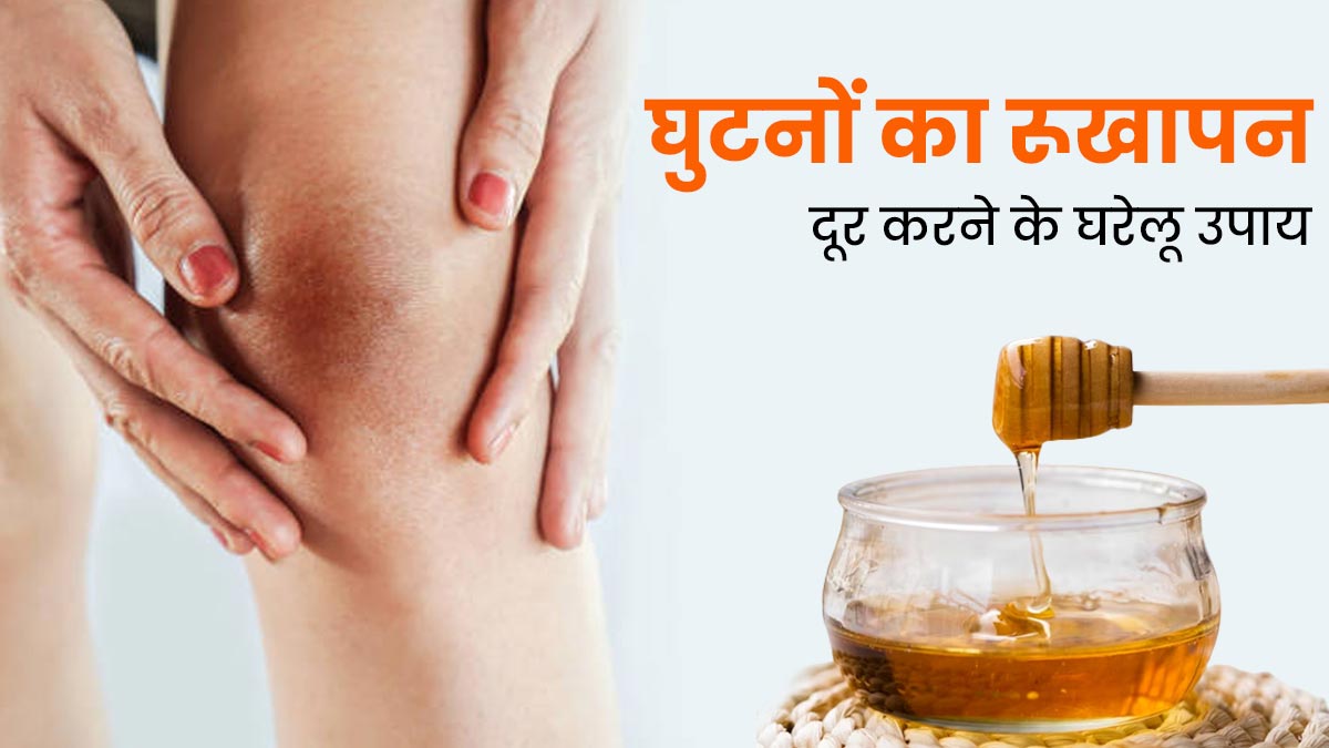 घुटनों की रूखी त्वचा से छुटकारा पाने के लिए आजमाएं ये 5 घरेलू उपाय, स्किन बनेगी सॉफ्ट