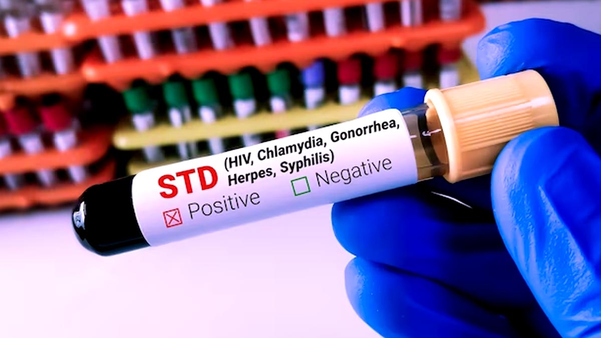 Healthy Practices To Curb The Spread Of STIs 