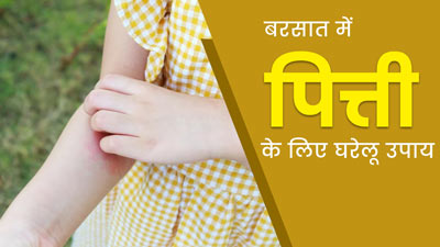 बरसात में पित्ती उछलने पर आजमाएं ये 5 घरेलू उपाय, समस्या से मिलेगी राहत