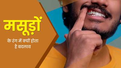 मसूड़ों के रंग में बदलाव क्यों हो जाता है? जानें इसके कारण और इलाज 