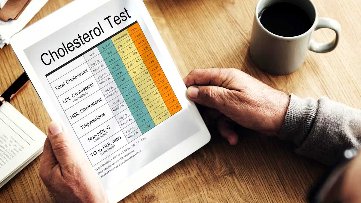 cholesterol-test