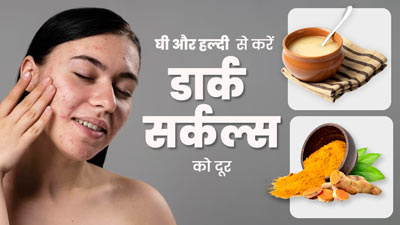 घी और हल्दी से करें डार्क सर्कल्स को दूर, जानें इस्तेमाल का तरीका 