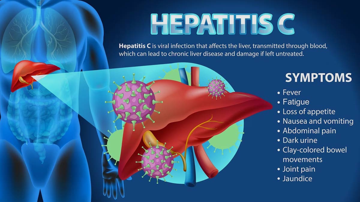 Digestive problems associated with hepatitis C