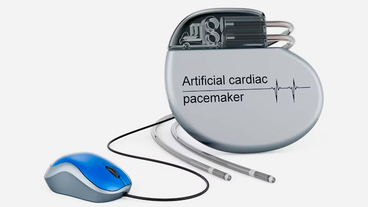 pacemaker