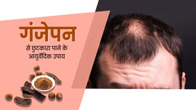 गंजेपन की समस्या से हैं परेशान? अपनाएं ये 5 आयुर्वेदिक उपाय, जिनसे दोबारा उगने लगेंगे बाल