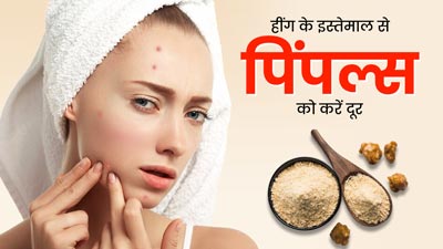 चेहरे पर इन तरीकों से करें हींग का इस्तेमाल, दूर होगी पिंपल्स की समस्या 