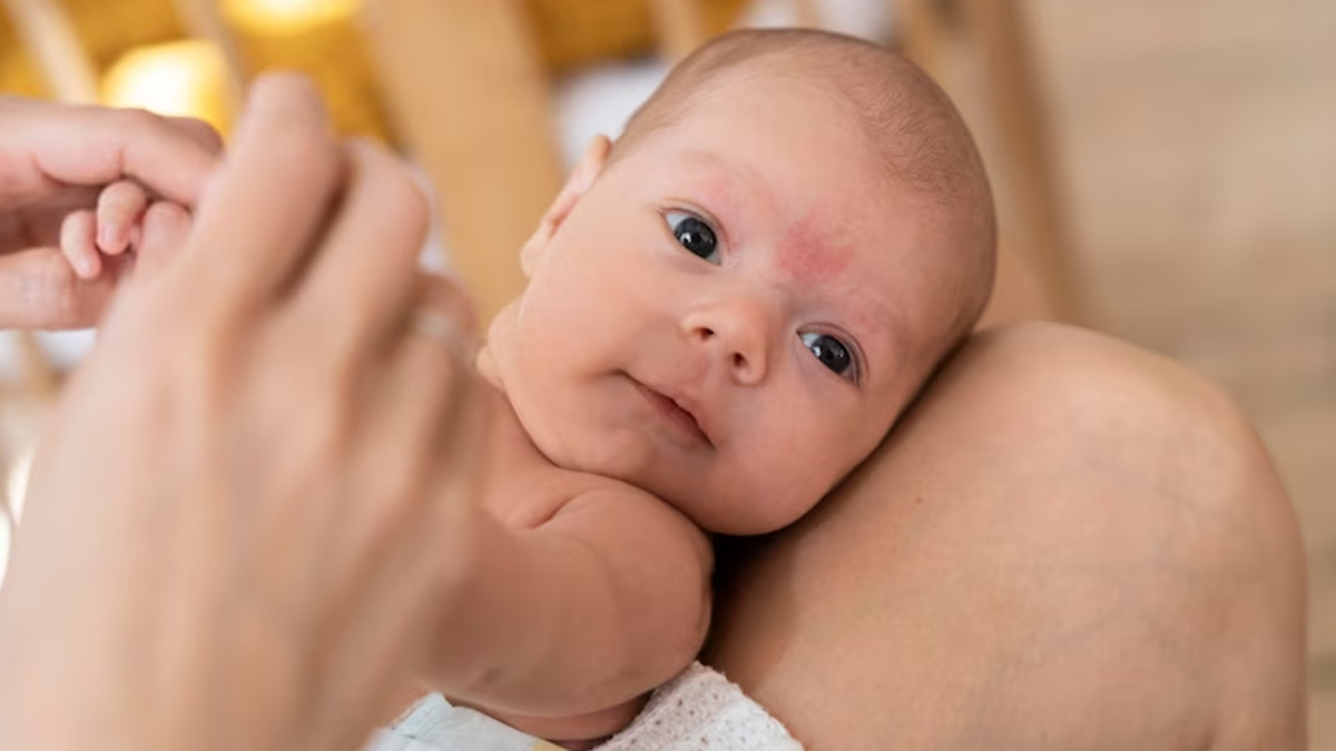 viral-rashes-in-babies-types-symptoms-and-treatment-being-the-parent