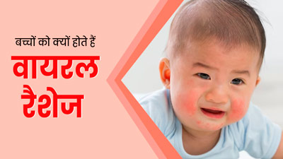 बच्चों को क्यों होते हैं वायरल रैशेज, जानें इलाज का तरीका 