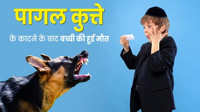 UP News: पागल कुत्ते के काटने से ढाई साल की बच्ची की मौत, कुत्ते के काटने पर फॉलो करें ये First Aid टिप्स