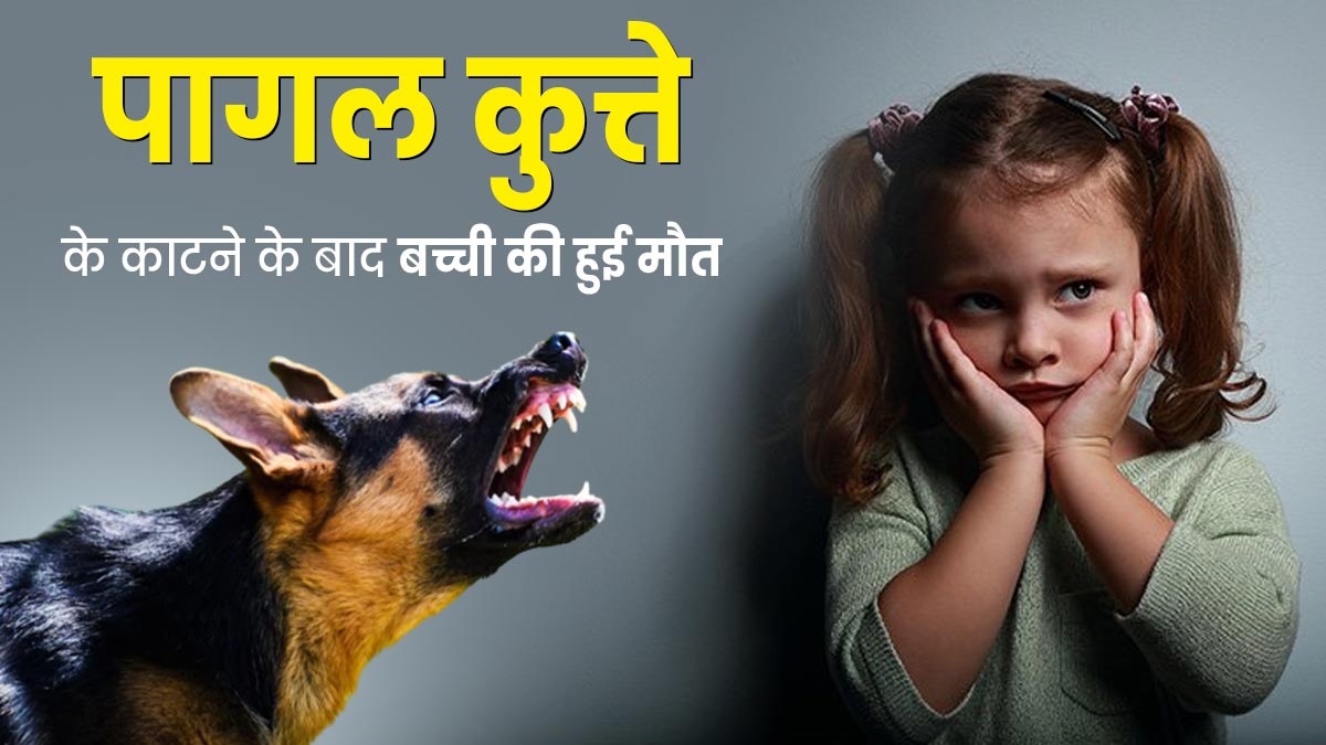 UP News: पागल कुत्ते के काटने से ढाई साल की बच्ची की मौत, कुत्ते के काटने पर फॉलो करें ये First Aid टिप्स