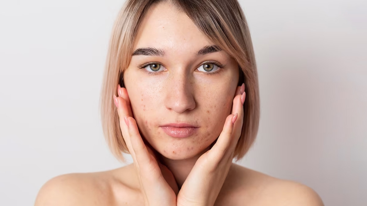 mulethi benefits for dark spots 