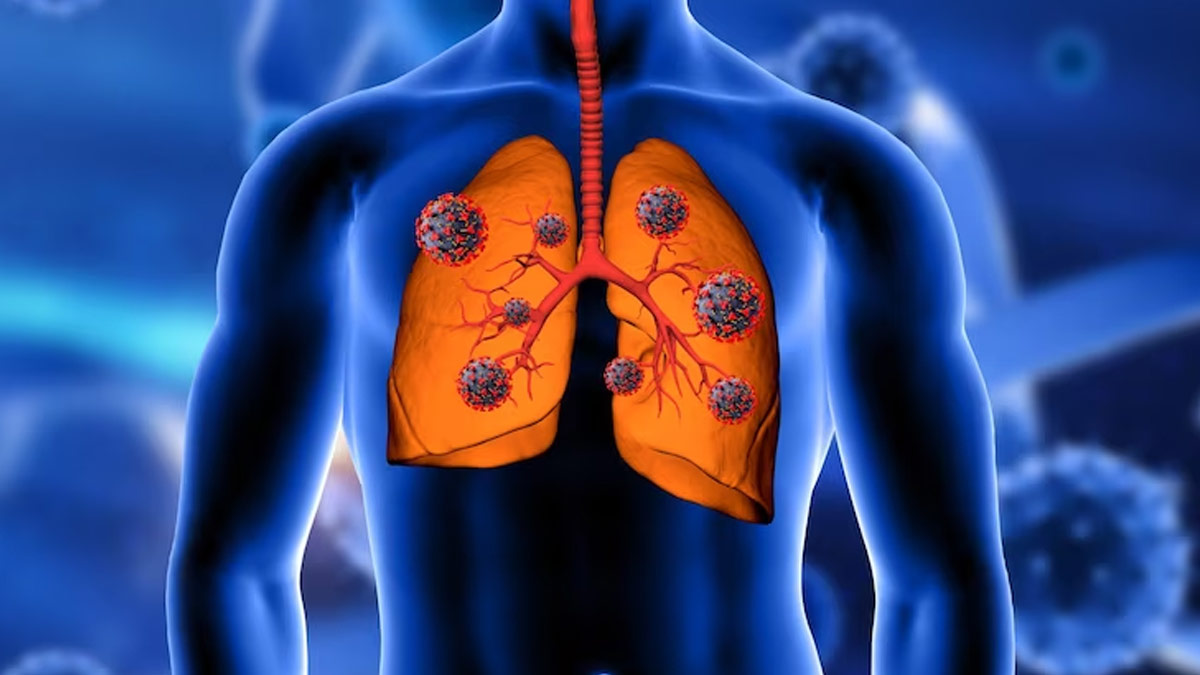 respiratory infection in monsoon