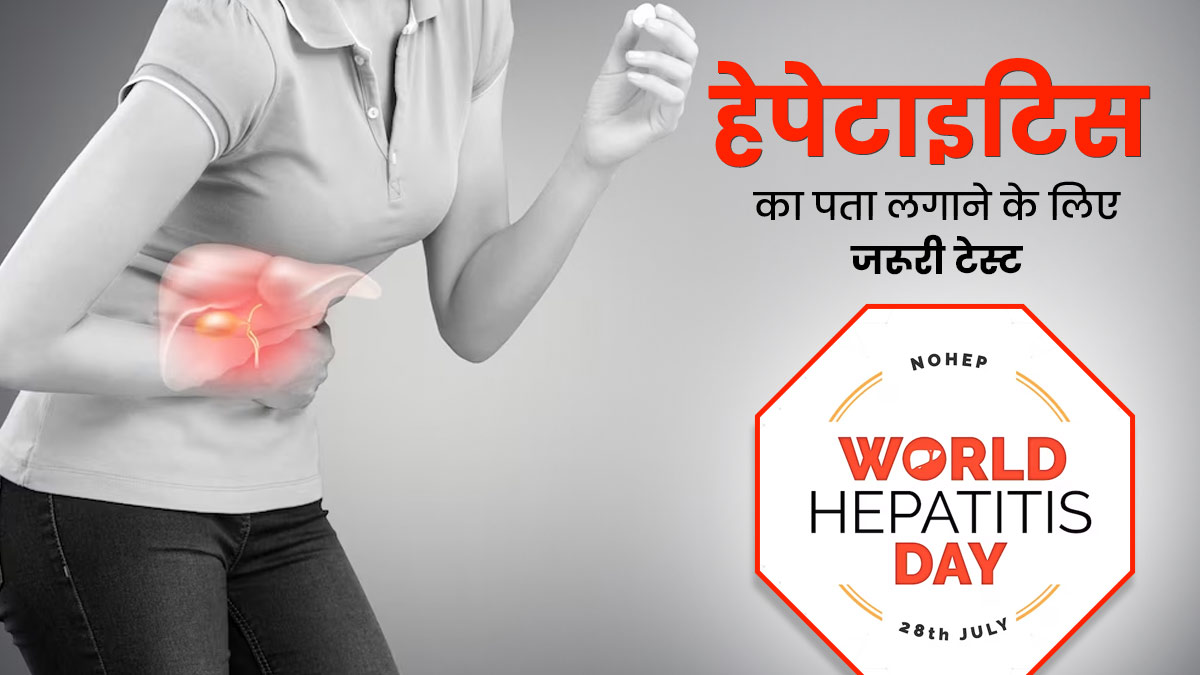 हेपेटाइटिस का पता लगाने के लिए कौन-कौन से टेस्ट होते हैं? डॉक्टर से जानें जरूरी टेस्ट