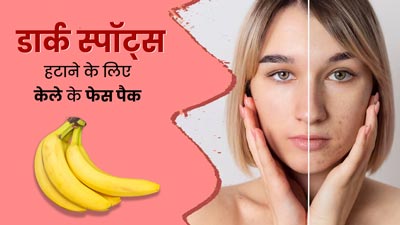 चेहरे के काले धब्बों को मिटाने के लिए लगाएं केले के ये 4 फेस पैक, स्किन बनेगी बेदाग