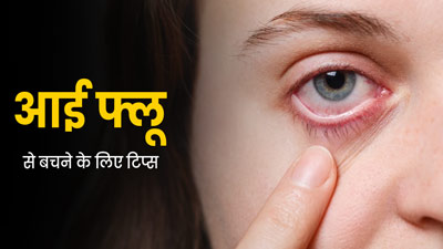 Eye Flu Precaution: आई फ्लू से बचने के लिए अपनाएं ये टिप्स, इंफेक्शन से होगा बचाव
