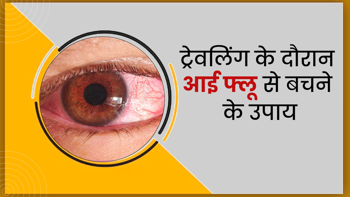 ट्रेवल के दौरान आई फ्लू से बचने के लिए अपनाएं ये 4 उपाय, आंखें रहेंगी सुरक्षित