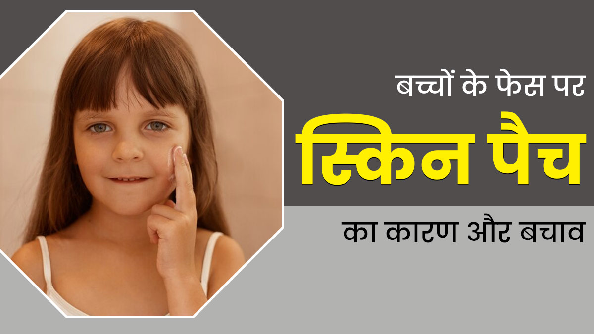 बच्चों के चेहरे पर पैच क्यों हो जाते हैं? जानें इसके कारण और बचाव