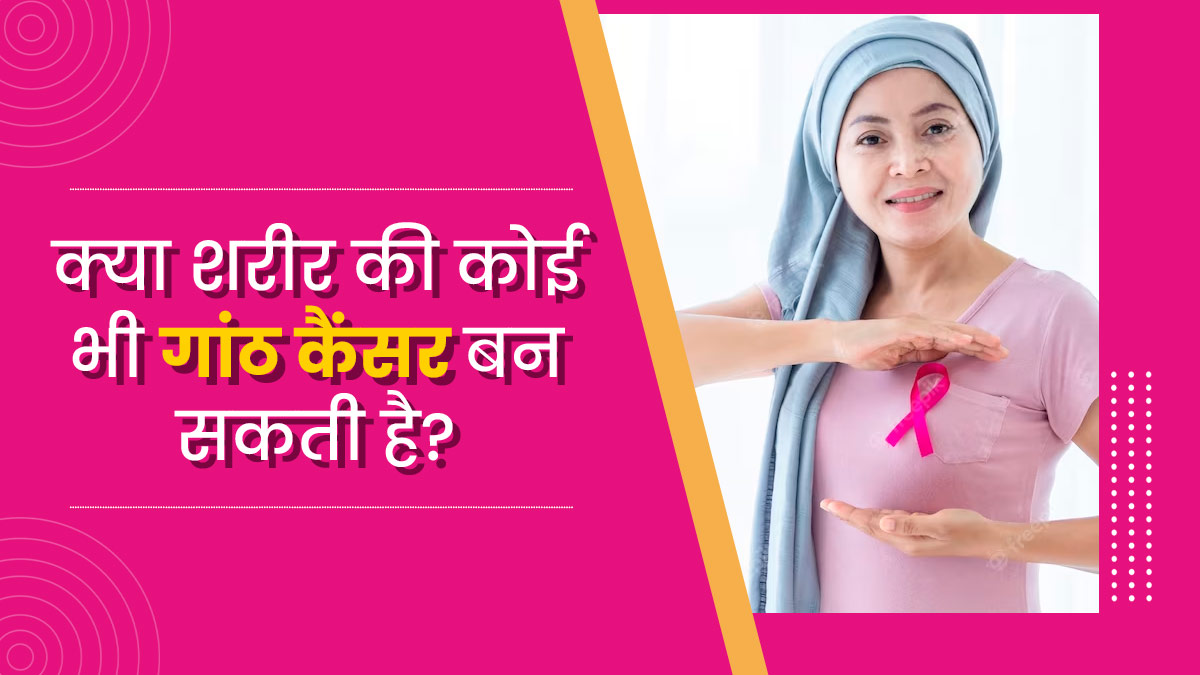क्या शरीर पर होने वाली कोई भी गांठ कैंसर बन सकती है? जानें क्या कहते हैं डॉक्टर