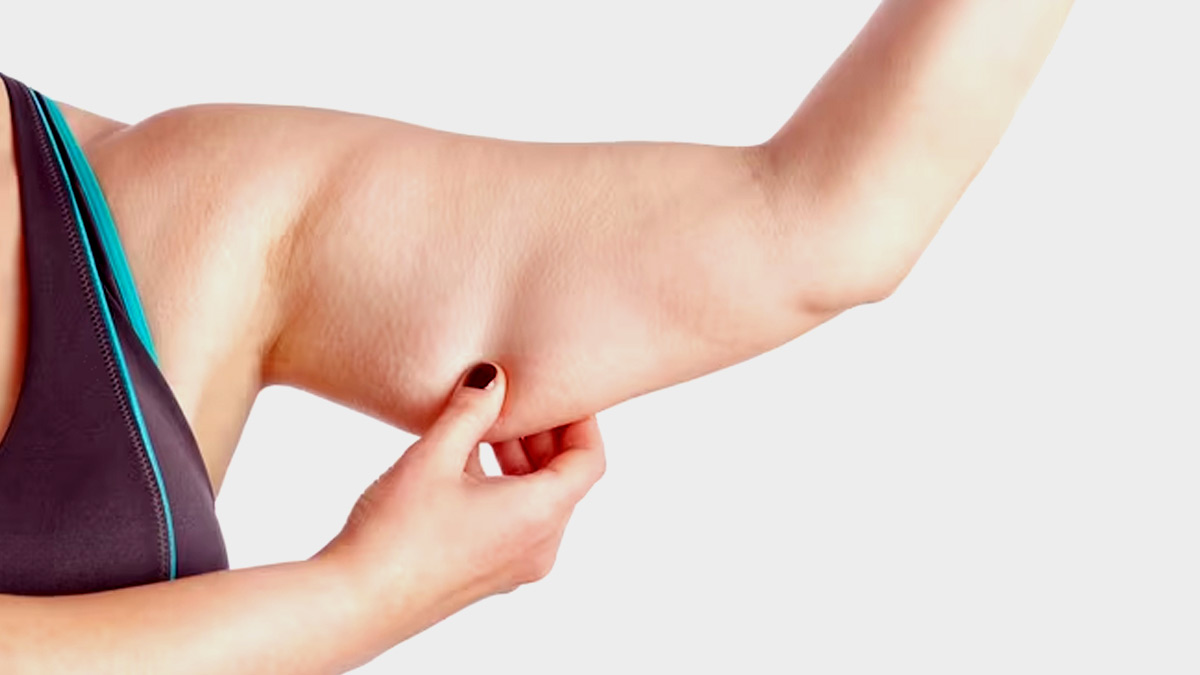 causes of fat around arm