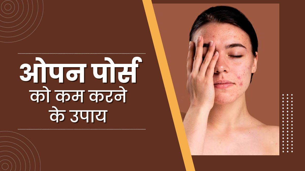 बार-बार स्क्रबिंग करने से ज्यादा खुल गए हैं पोर्स, तो अपनाएं ये घरेलू उपाय