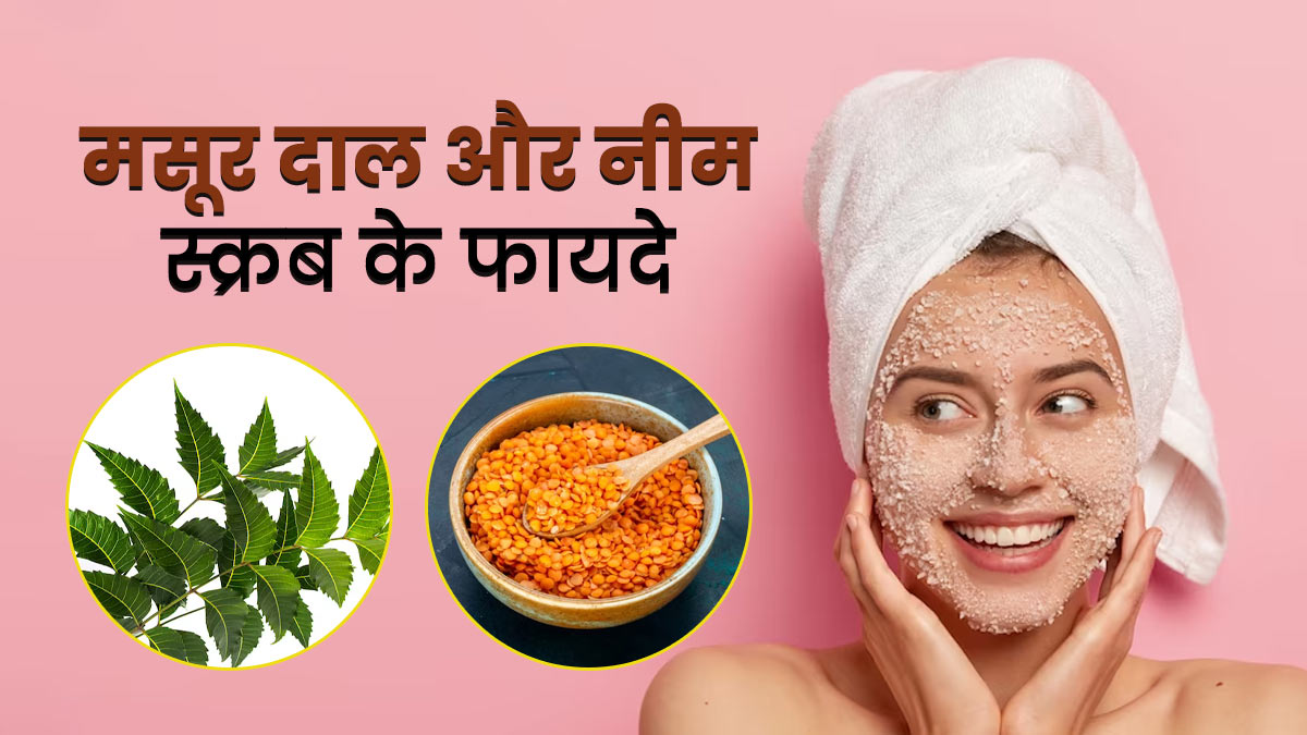 चेहरे के जिद्दी ब्‍लैकहेड्स मिटाने के लिए लगाएं मसूर दाल और नीम स्क्रब, जानें बनाने का तरीका