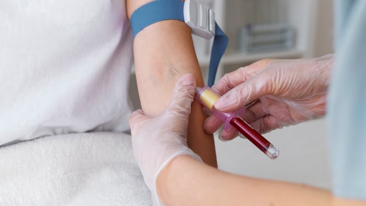 Understanding Plasma Exchange