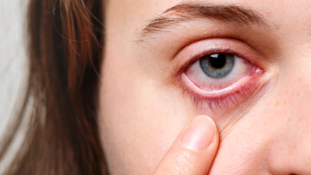 watery eye causes