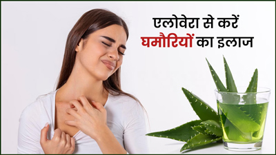 चुभती घमौरियों से छुटकारा दिलाएगा एलोवेरा, इन 4 तरीकों से करें इस्तेमाल