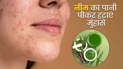 पिंपल्स से छुटकारा पाने के लिए ऐसे पिएं नीम का पानी, जानें इसके फायदे और बनाने का तरीका