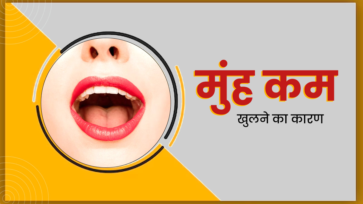 इन  कारणों से पूरा मुंह खोलने में हो सकती है दिक्कत, ट्राई करें ये 5 तरीके