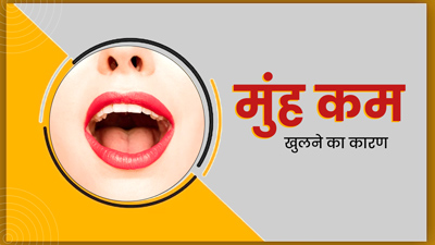 इन  कारणों से पूरा मुंह खोलने में हो सकती है दिक्कत, ट्राई करें ये 5 तरीके