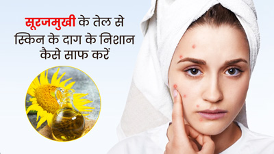 त्चचा के दाग-धब्बों को मिटा सकता है सूरजमुखी का तेल, जानें इस्तेमाल का तरीका