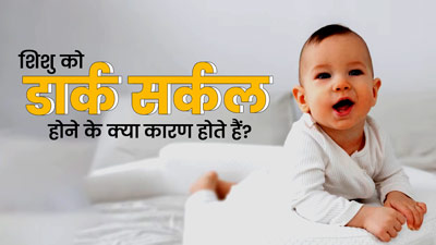 नवजात शिशु की आंखों के नीचे क्यों होते हैं डार्क सर्कल्स? जानें कारण और इलाज 