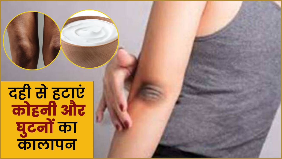 दही से दूर करें कोहनी और घुटनों का कालापन, जानें इस्तेमाल के 4 तरीके
