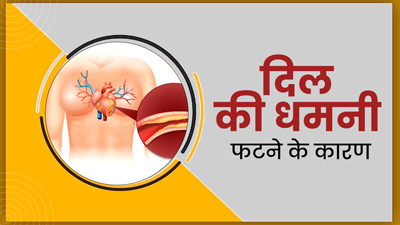 दिल की धमनी फटने के पीछे हो सकते हैं ये कारण, जानें बचाव के उपाय