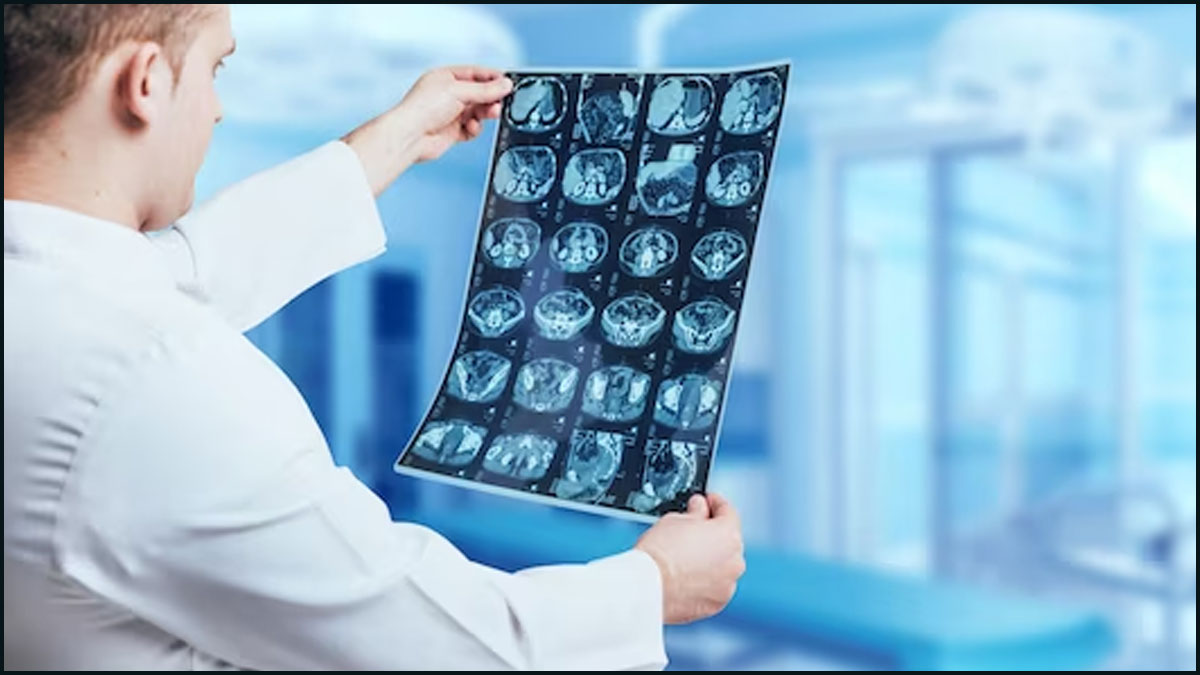 brain tumor