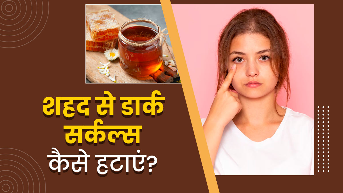 शहद से डार्क सर्कल्स कैसे हटाएं जानें इस्तेमाल के 4 तरीके Onlymyhealth