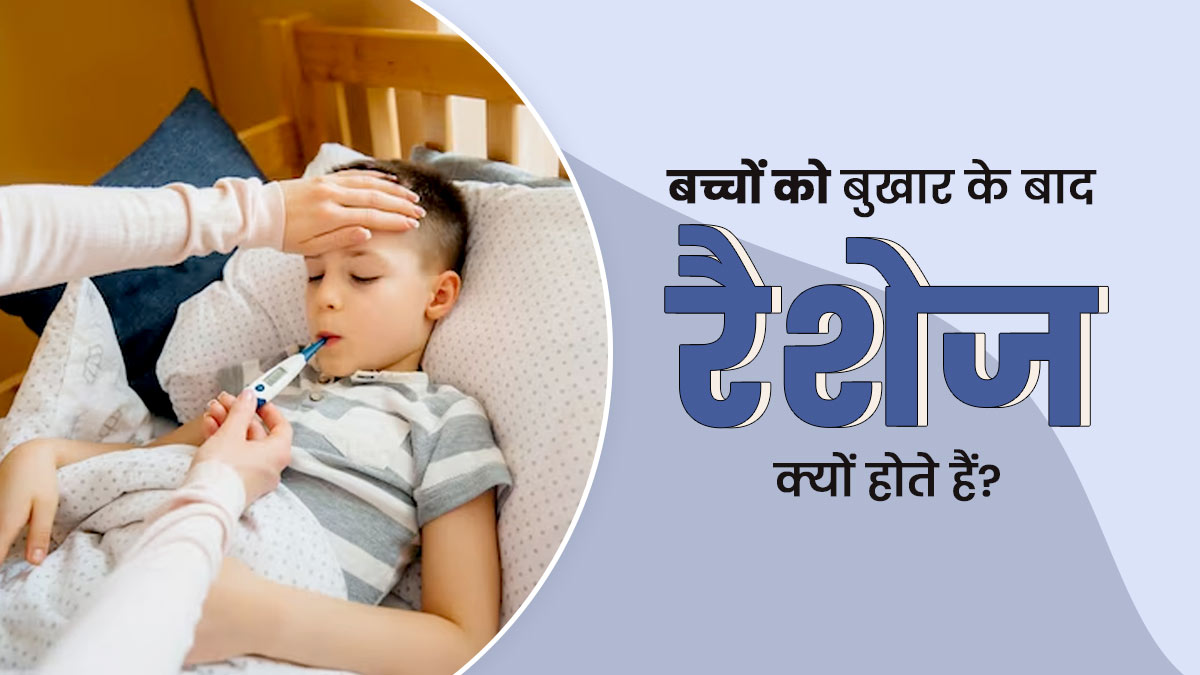 बुखार के बाद बच्चे को हो जाते हैं रैशेज? जानें इसके कारण और बचाव के उपाय 
