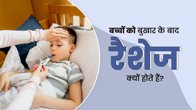 बुखार के बाद बच्चे को हो जाते हैं रैशेज? जानें इसके कारण और बचाव के उपाय 