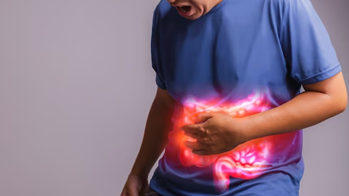 From Blood In Stool To Unexplained Weight Loss: Expert Lists 6 Signs Of  Bowel Cancer