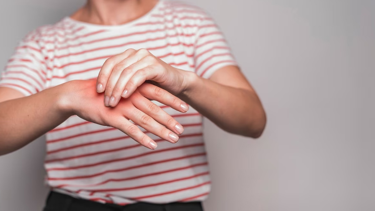 Early Symptoms Of High Uric Acid