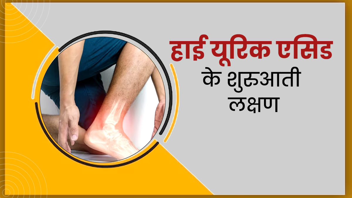 हाई यूरिक एसिड के ये हैं 5 शुरुआती लक्षण, न करें अनदेखा
