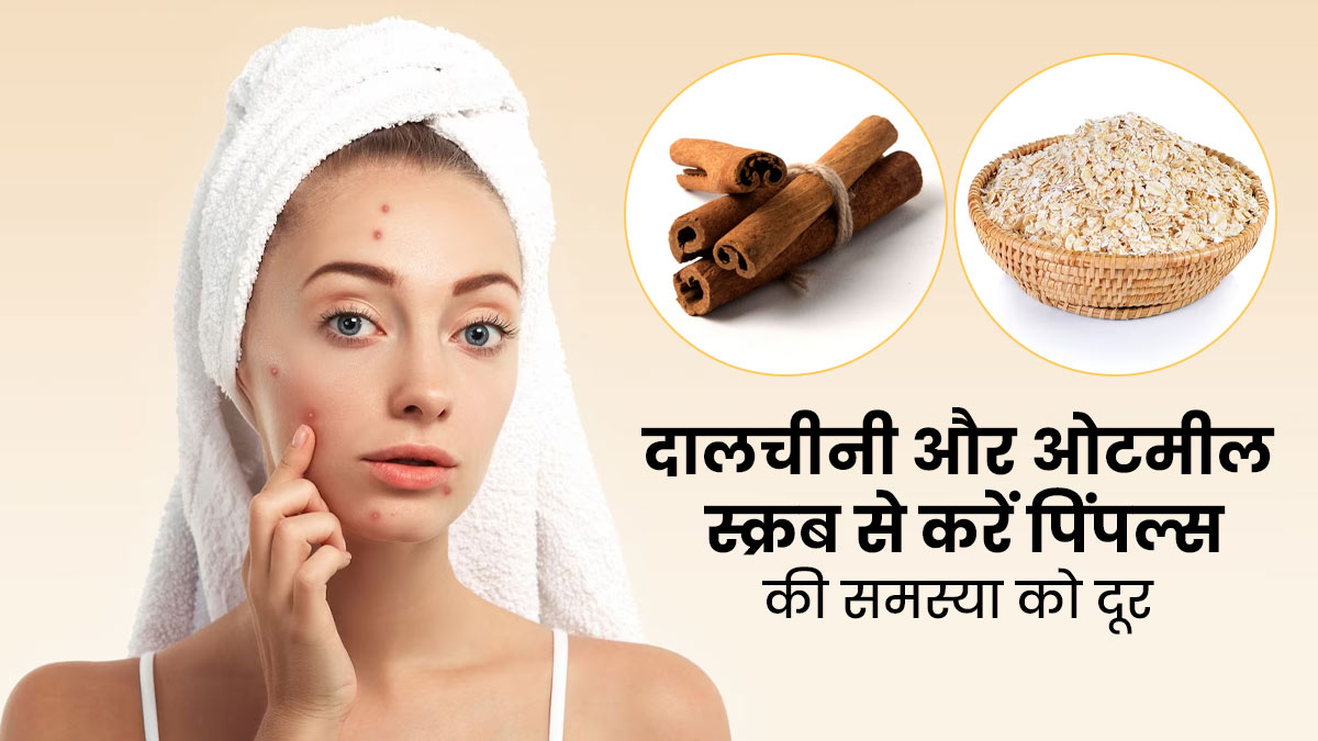 मुंहासों को दूर करेगा दालचीनी और ओटमील स्क्रब, जानें बनाने और प्रयोग का तरीका