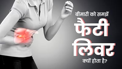 फैटी लिवर रोग क्यों होता है? डॉक्टर से आसान भाषा में समझें इसके कारण