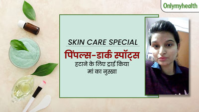 मुंहासों और दाग-धब्बों से खराब हो गया था सान्या का चेहरा, मम्मी के बताए इस फेस पैक से मिली बेदाग त्वचा