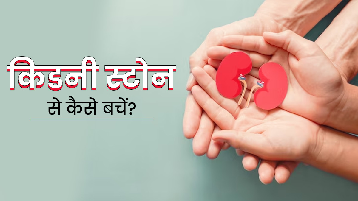 क‍िडनी स्‍टोन से बचने के ल‍िए फॉलो करें ये 5 टिप्स, डाइट और रूटीन में बदलाव है जरूरी