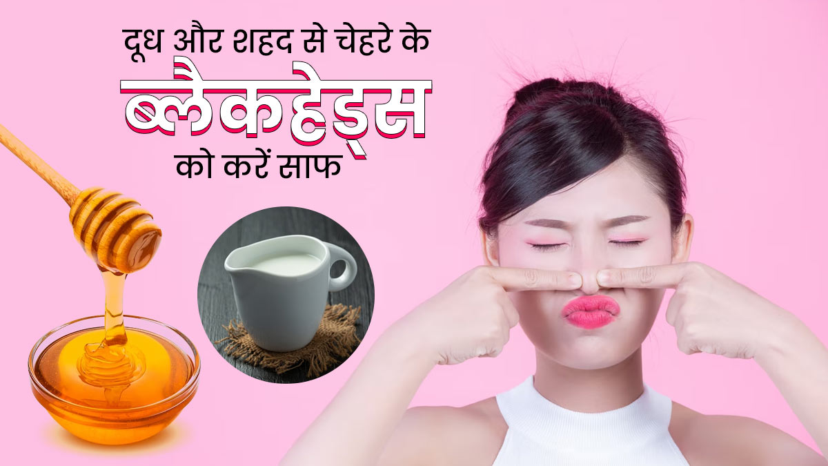 ब्लैकहेड्स हटाने में मदद करेगा दूध और शहद का पेस्ट, जानें उपयोग का तरीका
